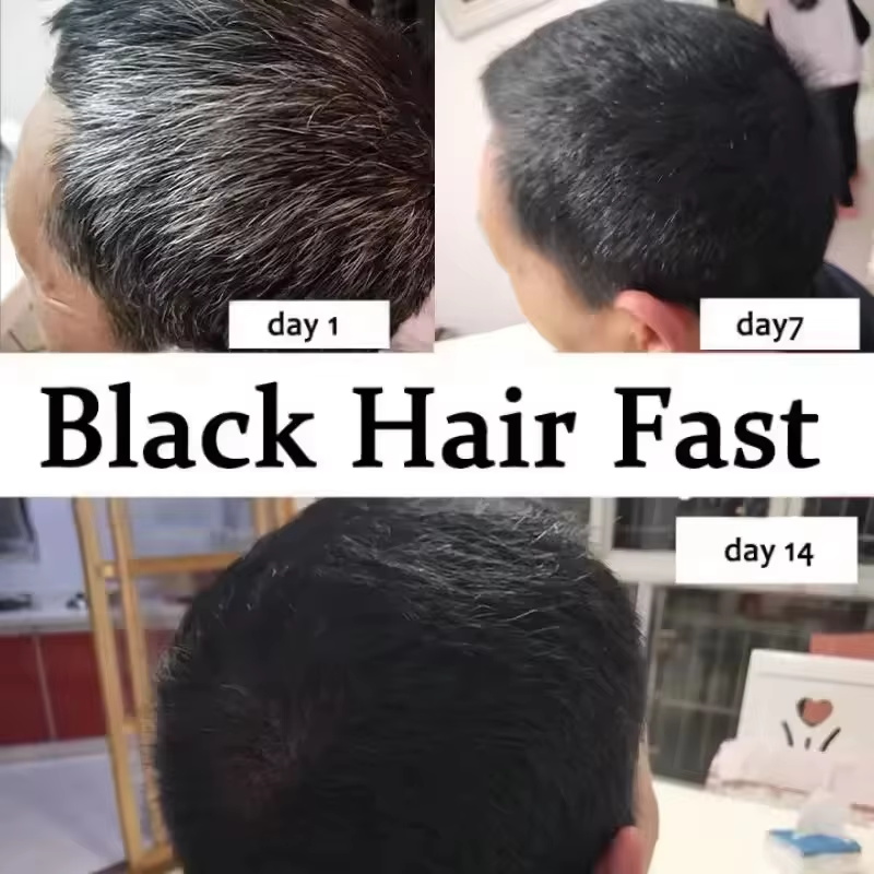 Serum Perawatan Rambut Putih A - Hair Care Natural Products ulasan dan harga