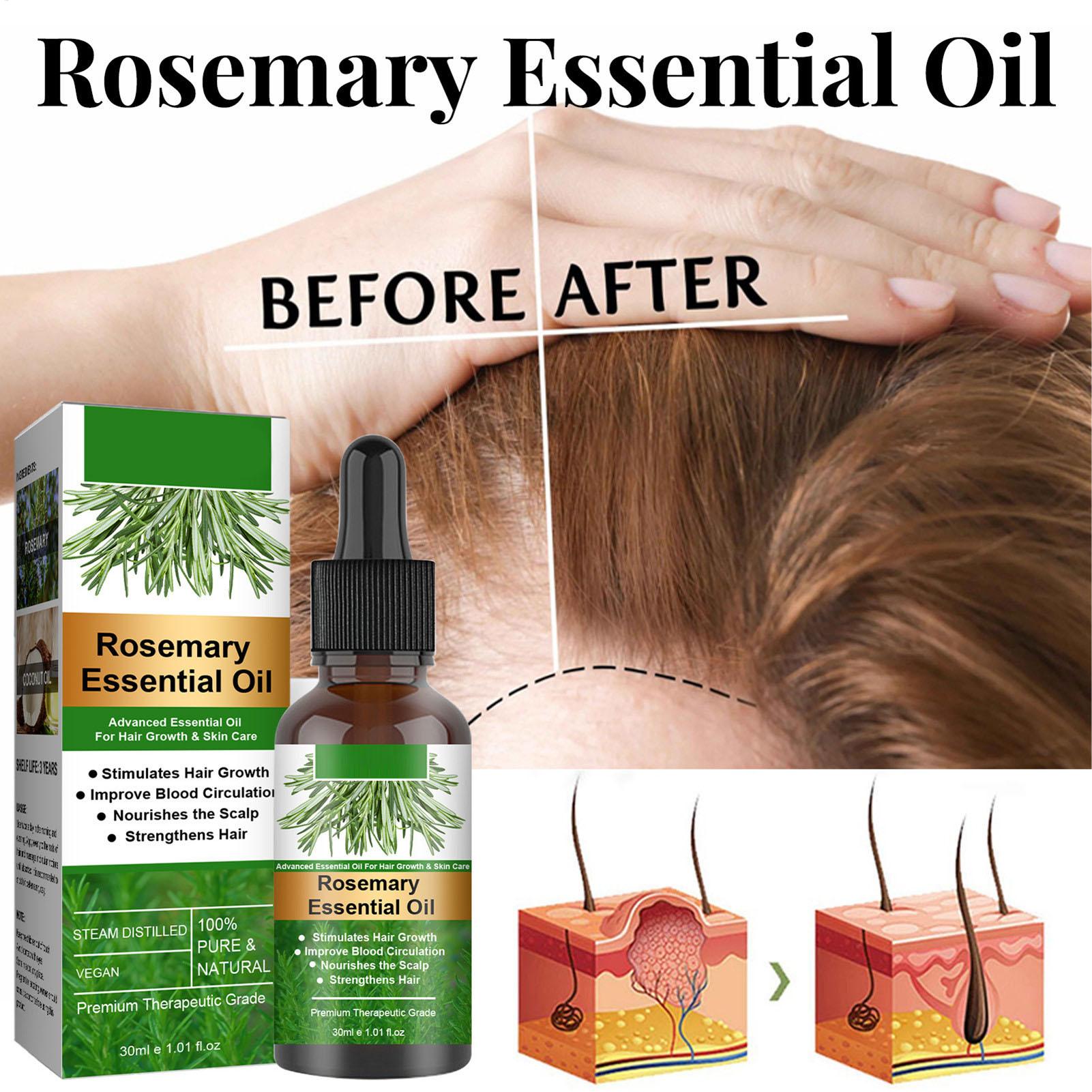 Minyak Esensial Rosemary Produ - Hair Care Natural Products ulasan dan harga