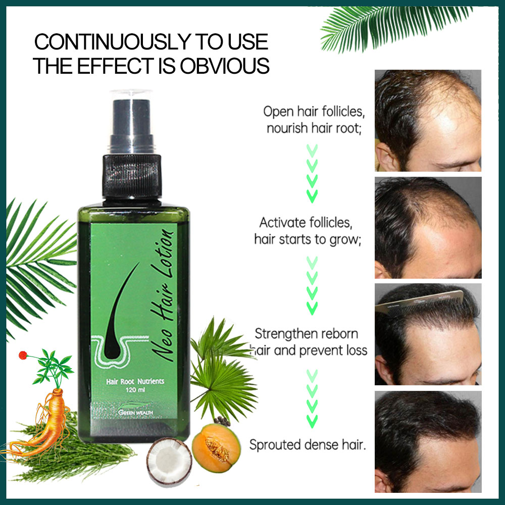 4 pcs Neo Hair Lotion 120ml Ca - Hair Care With Protein ulasan dan harga