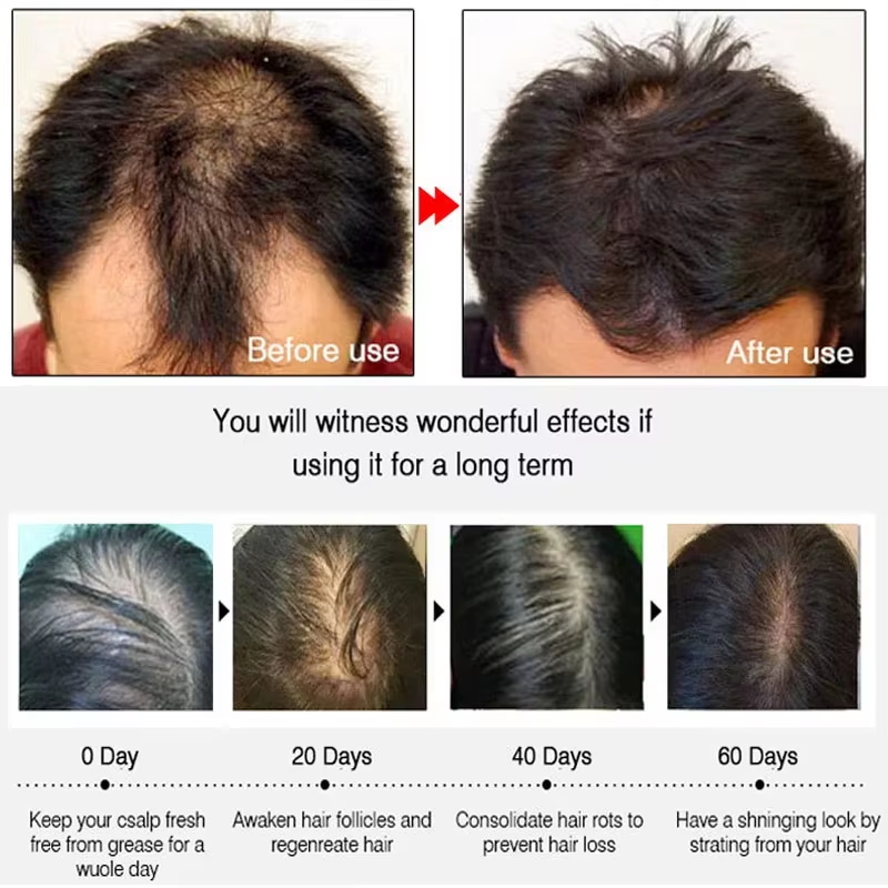 Semprotan Penumbuh Rambut Jahe - Hair Care Natural Products ulasan dan harga